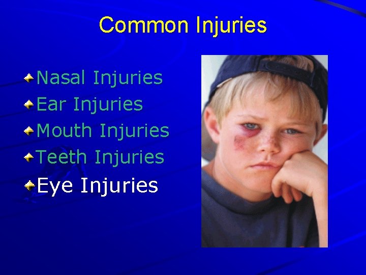 Common Injuries Nasal Injuries Ear Injuries Mouth Injuries Teeth Injuries Eye Injuries 