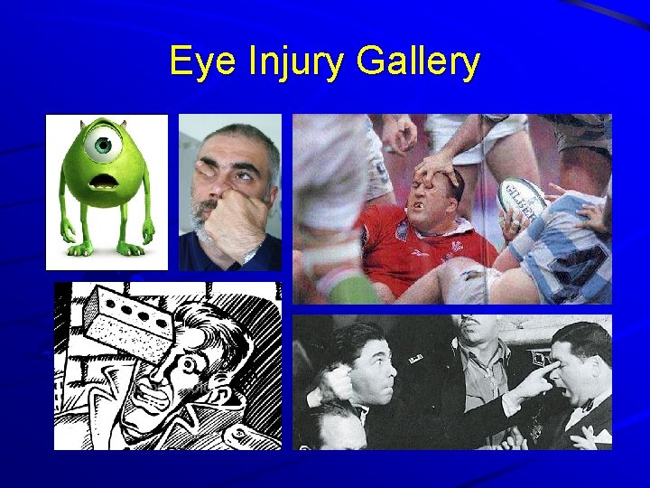 Eye Injury Gallery 