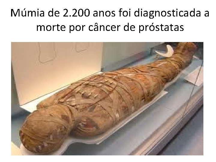 Múmia de 2. 200 anos foi diagnosticada a morte por câncer de próstatas 