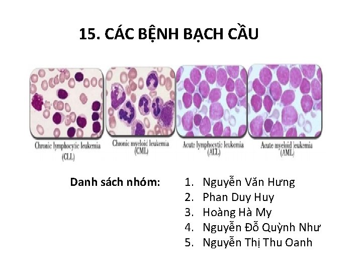 15. CÁC BỆNH BẠCH CẦU Danh sách nhóm: 1. 2. 3. 4. 5. Nguyễn