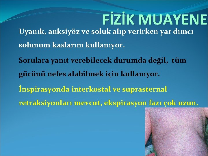 FİZİK MUAYENE Uyanık, anksiyöz ve soluk alıp verirken yar dımcı solunum kaslarını kullanıyor. Sorulara