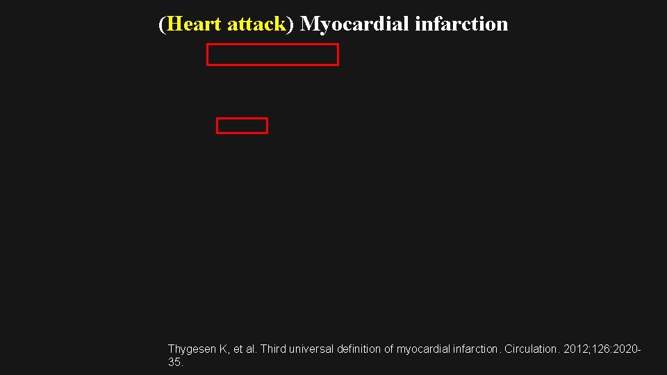 (Heart attack) Myocardial infarction Thygesen K, et al. Third universal definition of myocardial infarction.