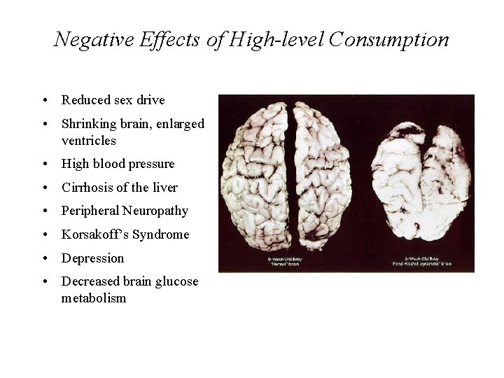 Negative Effects of High-level Consumption • Reduced sex drive • Shrinking brain, enlarged ventricles