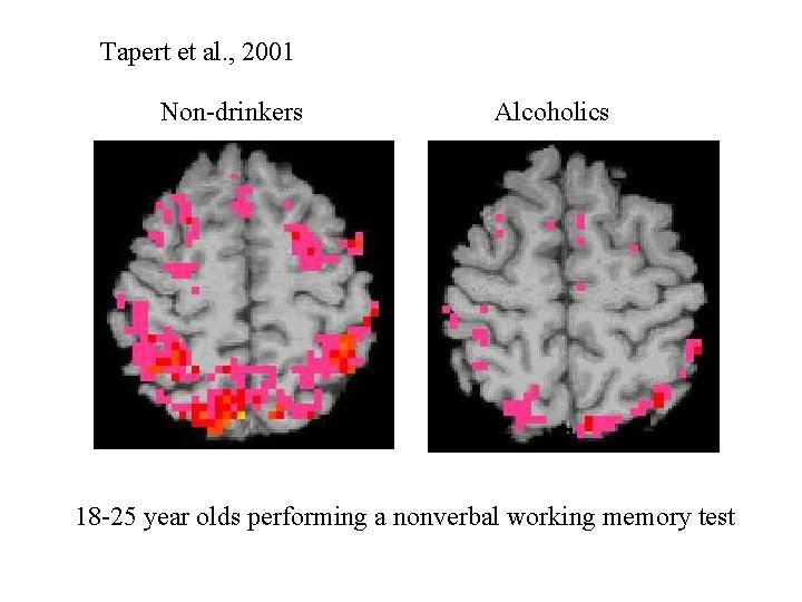 Tapert et al. , 2001 Non-drinkers Alcoholics 18 -25 year olds performing a nonverbal