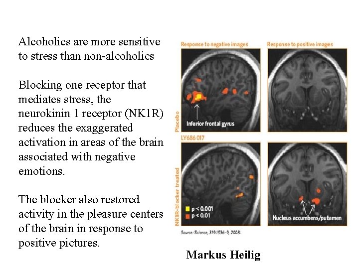 Alcoholics are more sensitive to stress than non-alcoholics Blocking one receptor that mediates stress,