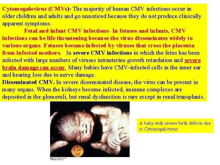 Cytomegalovirus (CMVs)- The majority of human CMV infections occur in older children and adults