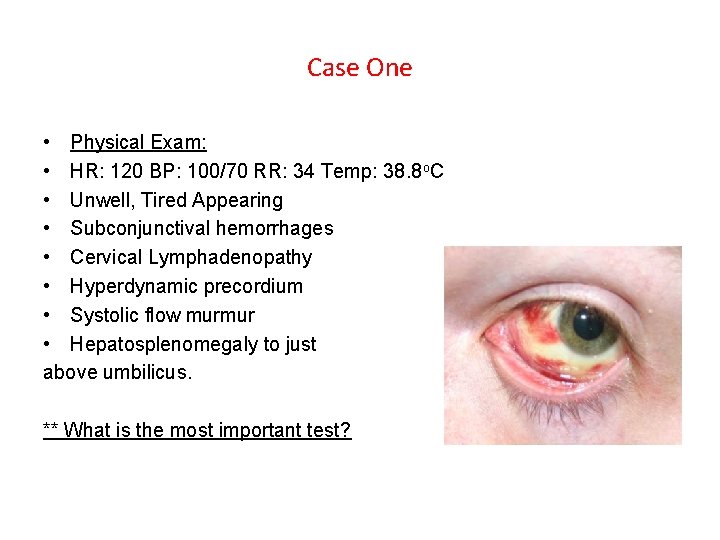 Case One • Physical Exam: • HR: 120 BP: 100/70 RR: 34 Temp: 38. Case One • Physical Exam: • HR: 120 BP: 100/70 RR: 34 Temp: 38.
