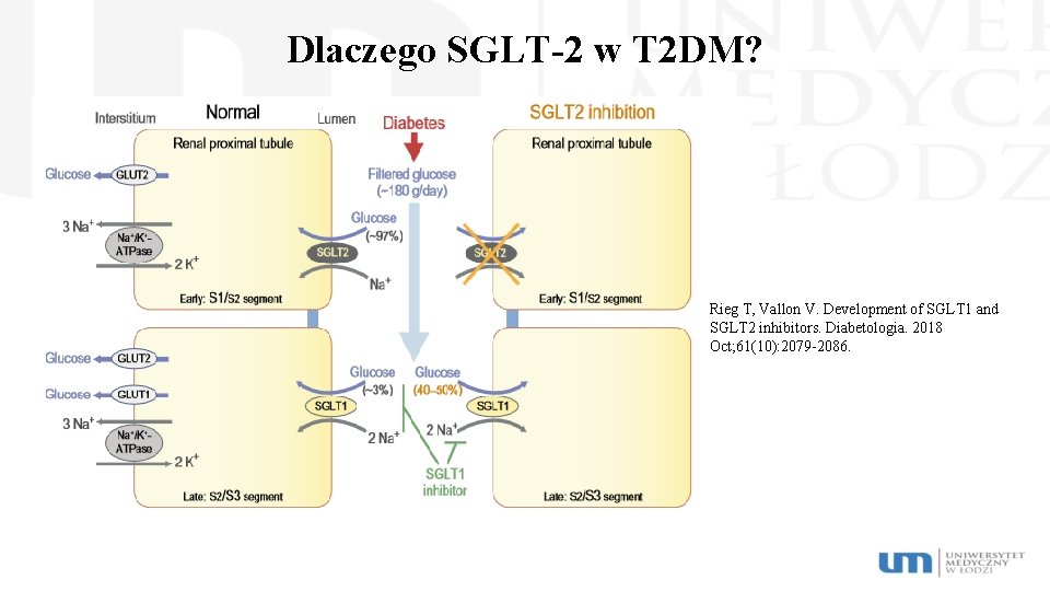 Dlaczego SGLT-2 w T 2 DM? Rieg T, Vallon V. Development of SGLT 1