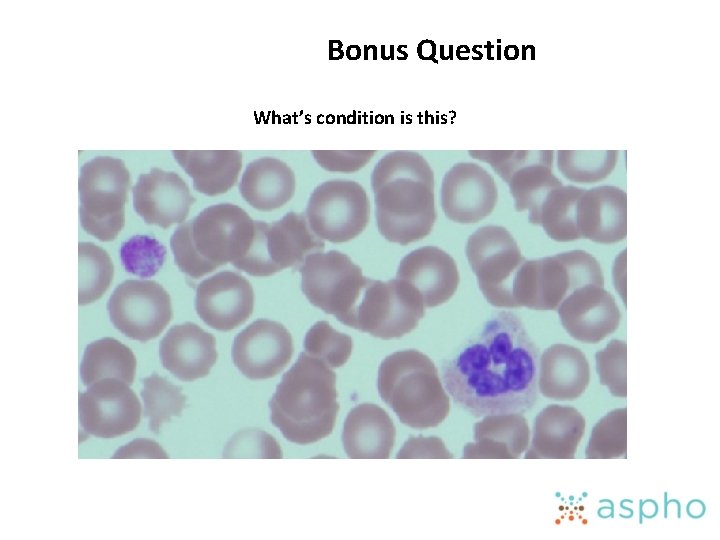 Bonus Question What’s condition is this? 