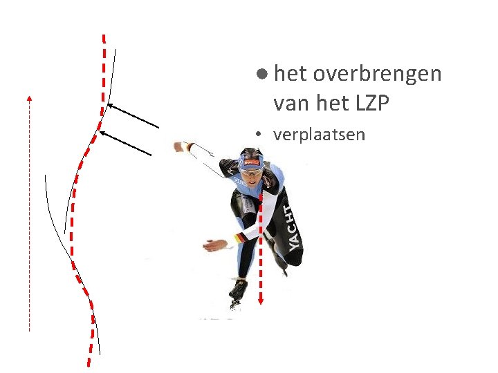 ● het overbrengen van het LZP • verplaatsen 
