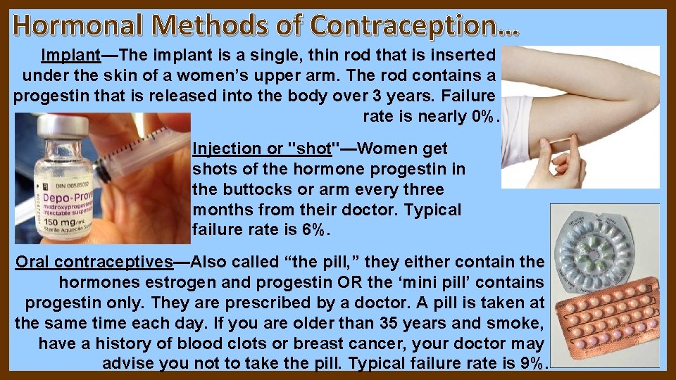 Hormonal Methods of Contraception… Implant—The implant is a single, thin rod that is inserted Hormonal Methods of Contraception… Implant—The implant is a single, thin rod that is inserted