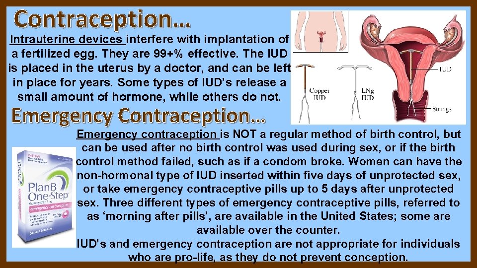 Contraception… Intrauterine devices interfere with implantation of a fertilized egg. They are 99+% effective. Contraception… Intrauterine devices interfere with implantation of a fertilized egg. They are 99+% effective.