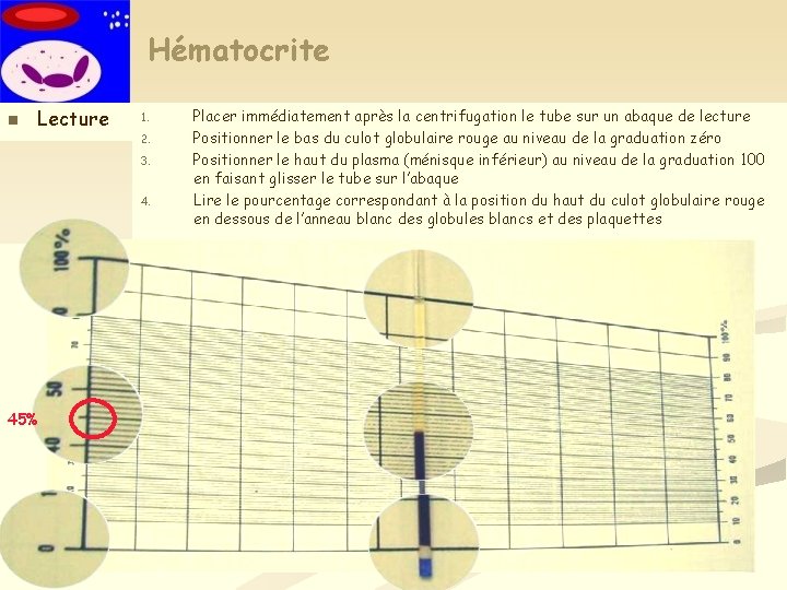 Hématocrite n Lecture 1. 2. 3. 4. 45% Placer immédiatement après la centrifugation le Hématocrite n Lecture 1. 2. 3. 4. 45% Placer immédiatement après la centrifugation le