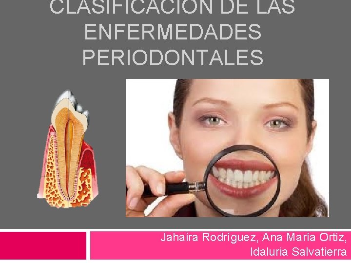 CLASIFICACIÓN DE LAS ENFERMEDADES PERIODONTALES Jahaira Rodríguez, Ana María Ortiz, Idaluria Salvatierra 