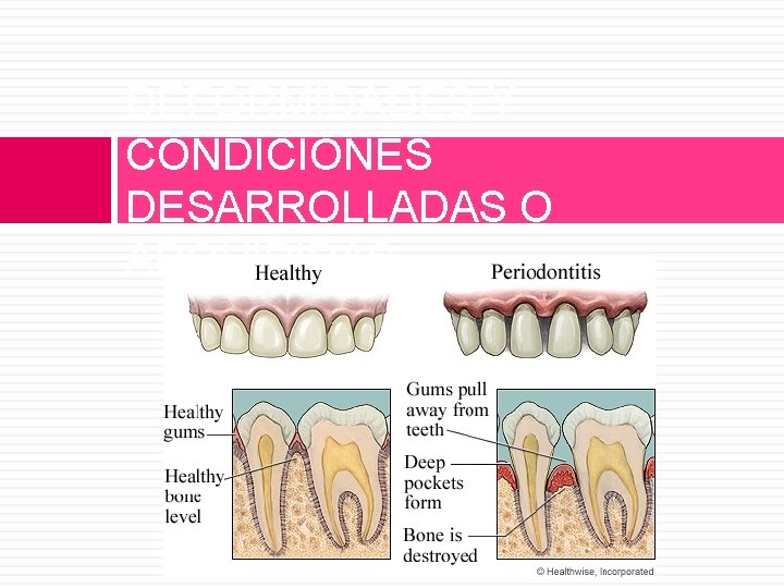 DEFORMIDADES Y CONDICIONES DESARROLLADAS O ADQUIRIDAS 