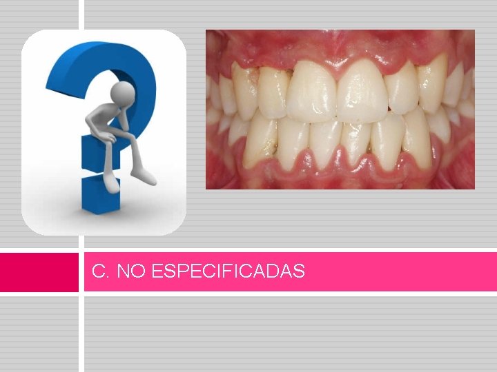 C. NO ESPECIFICADAS 