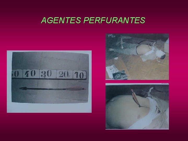 AGENTES PERFURANTES AGENTES PERFURANTES