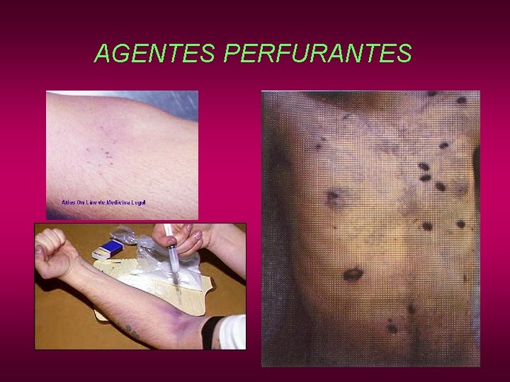 AGENTES PERFURANTES AGENTES PERFURANTES
