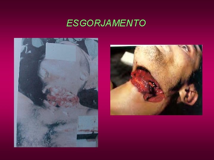 ESGORJAMENTO ESGORJAMENTO