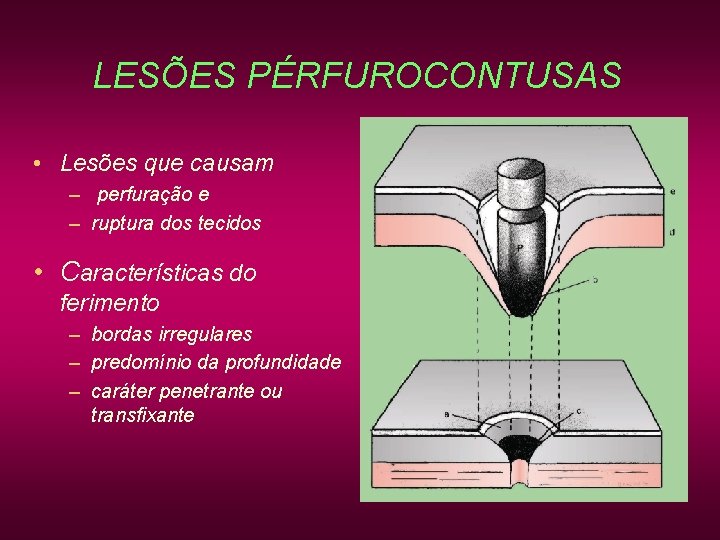 LESÕES PÉRFUROCONTUSAS • Lesões que causam – perfuração e – ruptura dos tecidos • LESÕES PÉRFUROCONTUSAS • Lesões que causam – perfuração e – ruptura dos tecidos •