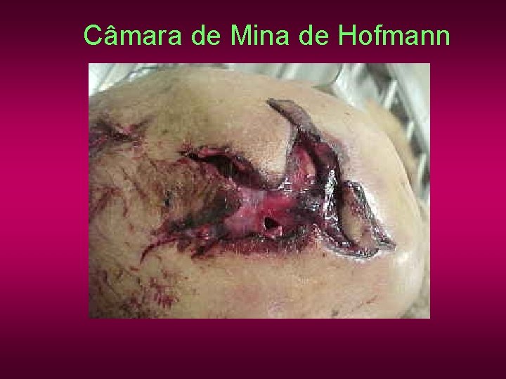 Câmara de Mina de Hofmann Câmara de Mina de Hofmann