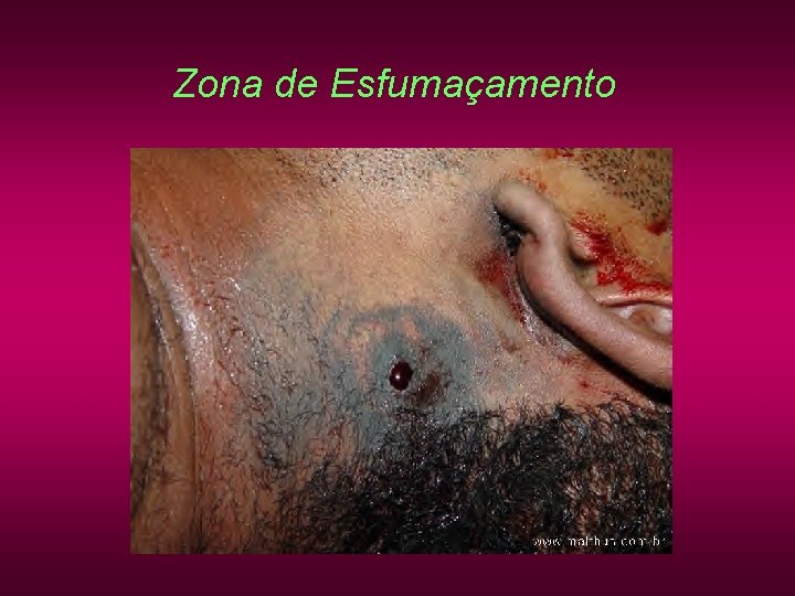 Zona de Esfumaçamento Zona de Esfumaçamento