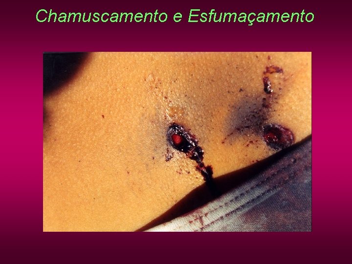 Chamuscamento e Esfumaçamento Chamuscamento e Esfumaçamento
