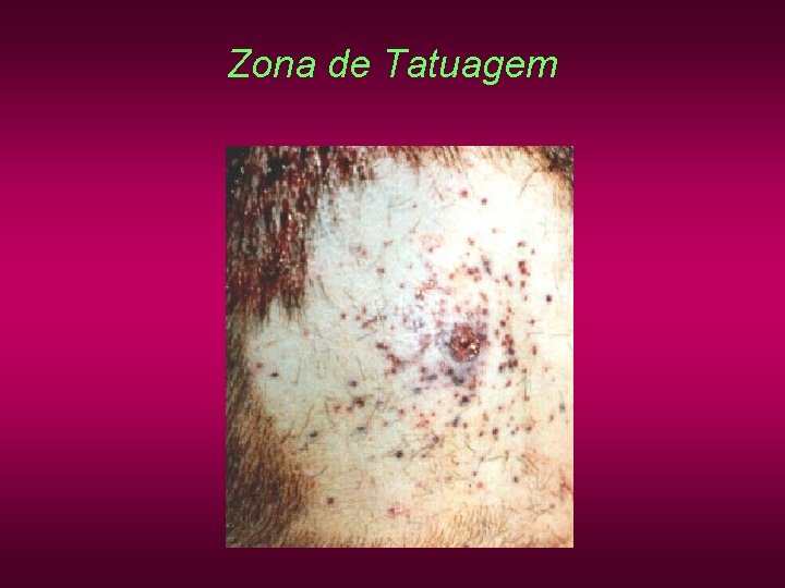 Zona de Tatuagem Zona de Tatuagem