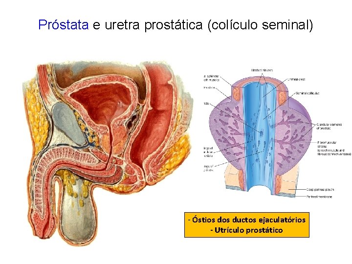 Próstata e uretra prostática (colículo seminal) - Óstios ductos ejaculatórios - Utrículo prostático 