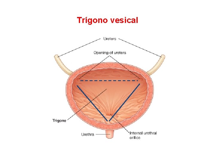 Trígono vesical 