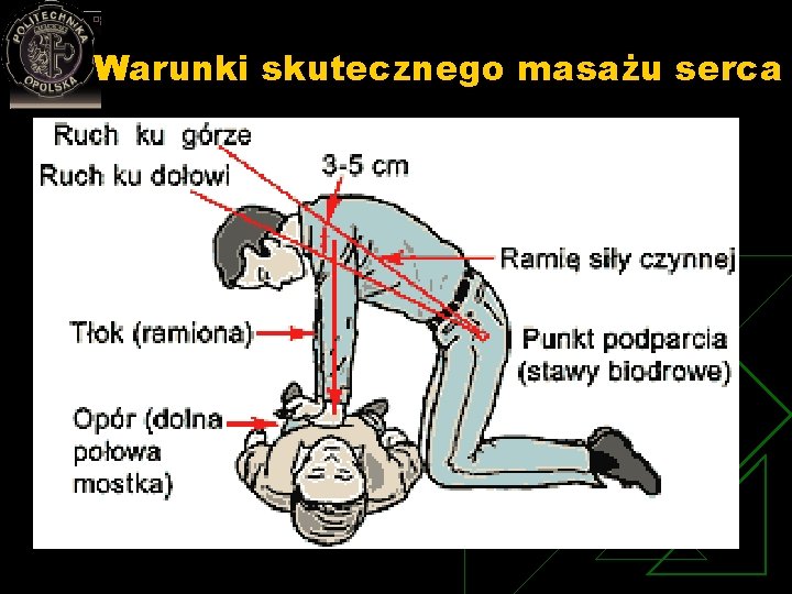 Warunki skutecznego masażu serca u Twarde podłoże u Właściwy punkt przyłożenia rąk: n 1/3