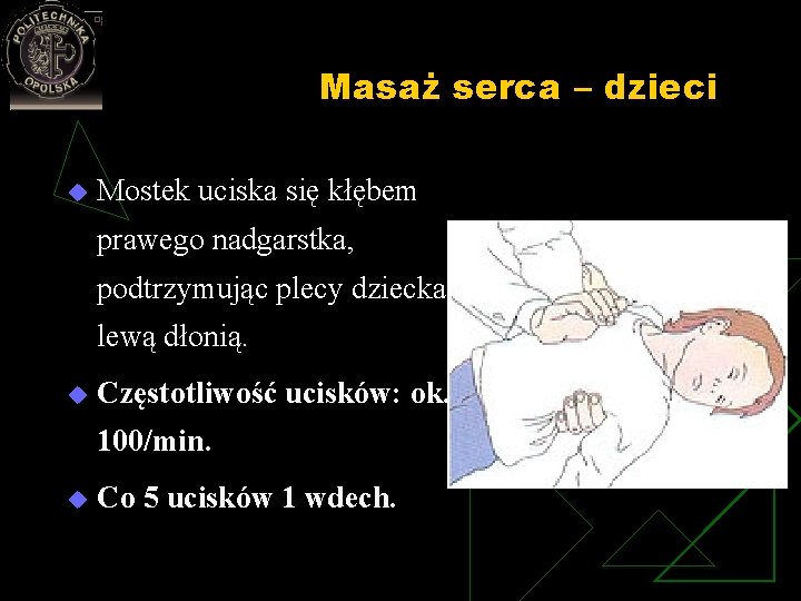 Masaż serca – dzieci u Mostek uciska się kłębem prawego nadgarstka, podtrzymując plecy dziecka