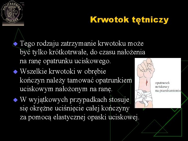 Krwotok tętniczy Tego rodzaju zatrzymanie krwotoku może być tylko krótkotrwałe, do czasu nałożenia na