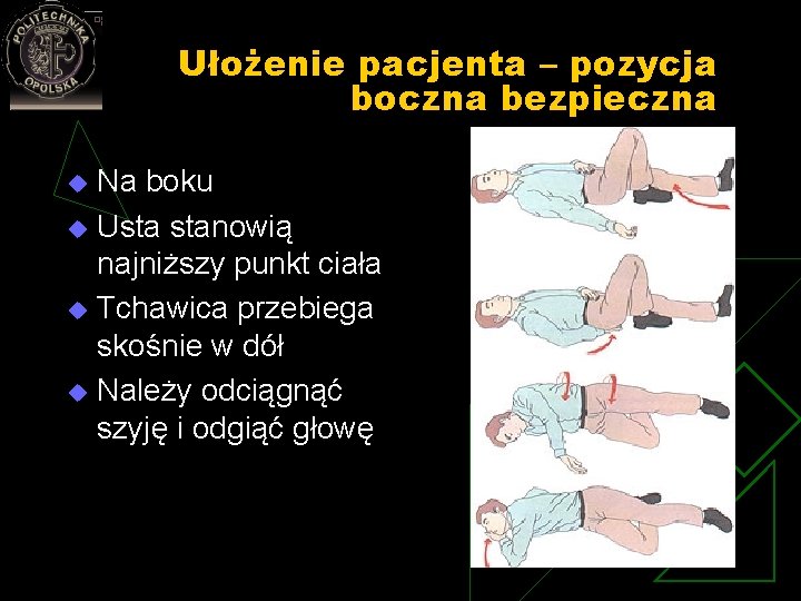 Ułożenie pacjenta – pozycja boczna bezpieczna Na boku u Usta stanowią najniższy punkt ciała