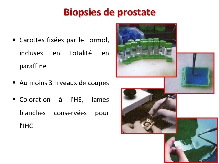 Biopsies de prostate § Carottes fixées par le Formol, incluses en totalité en paraffine