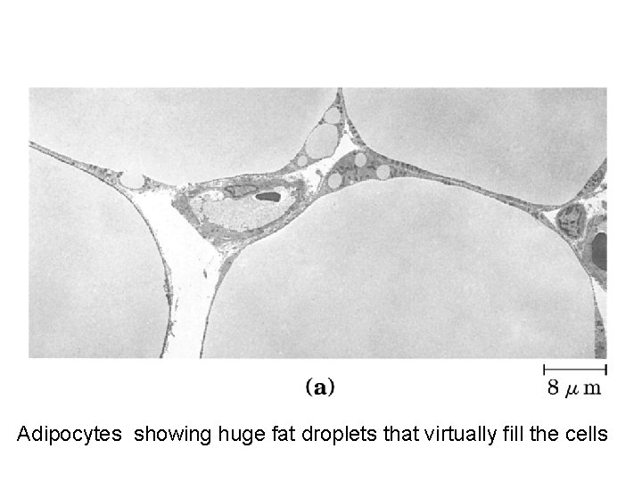 Adipocytes showing huge fat droplets that virtually fill the cells 