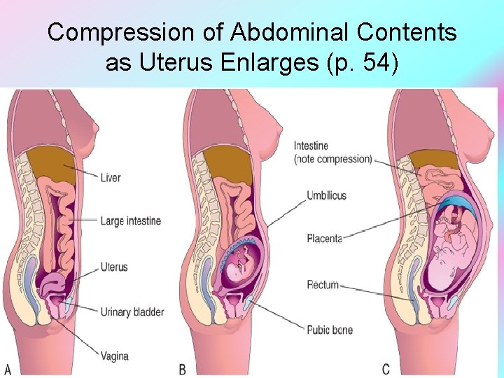 Compression of Abdominal Contents as Uterus Enlarges (p. 54) Elsevier items and derived items