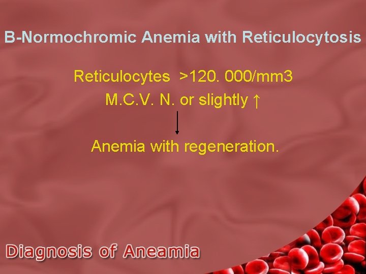 B-Normochromic Anemia with Reticulocytosis Reticulocytes >120. 000/mm 3 M. C. V. N. or slightly