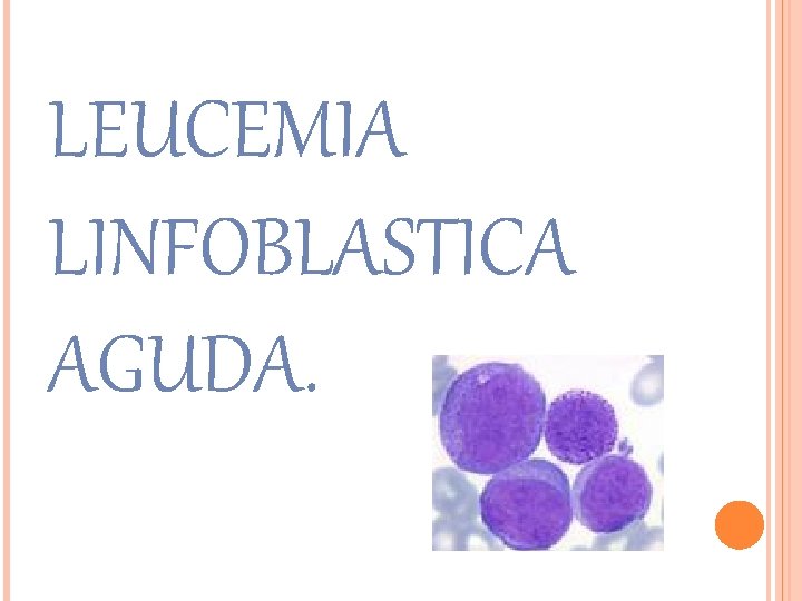 LEUCEMIA LINFOBLASTICA AGUDA. 