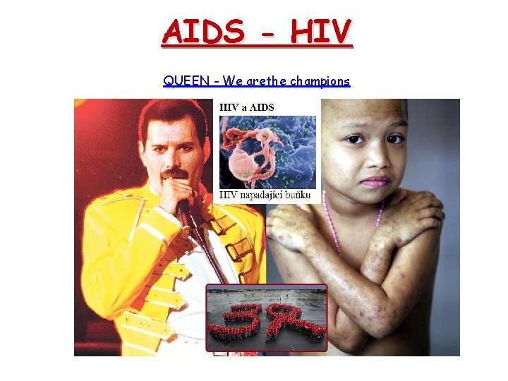 AIDS - HIV QUEEN - We arethe champions 