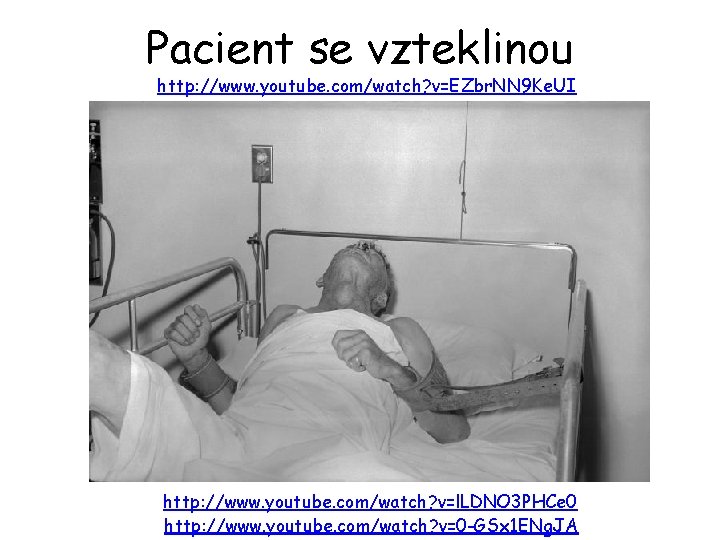 Pacient se vzteklinou http: //www. youtube. com/watch? v=EZbr. NN 9 Ke. UI http: //www.