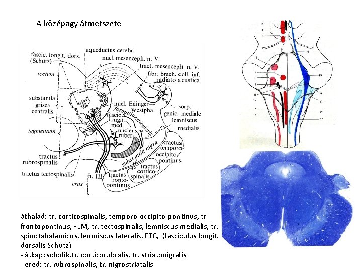 A középagy átmetszete áthalad: tr. corticospinalis, temporo-occipito-pontinus, tr frontopontinus, FLM, tr. tectospinalis, lemniscus medialis,