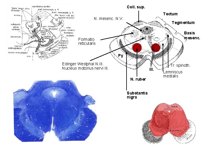 Coll. sup. Tectum N. mesenc. N. V. Tegmentum Basis mesenc. Formatio reticularis Py Edinger