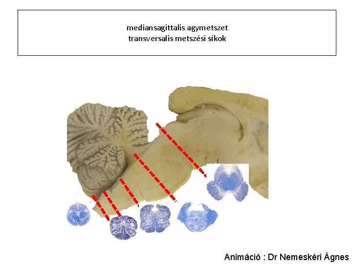 mediansagittalis agymetszet transversalis metszési síkok Animáció : Dr Nemeskéri Ágnes 