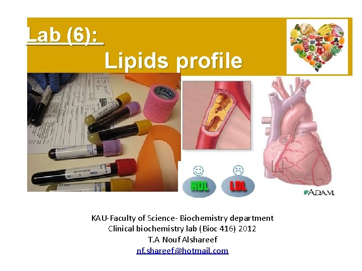 Lab (6): Lipids profile KAU-Faculty of Science- Biochemistry department Clinical biochemistry lab (Bioc 416)