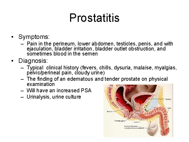 prostatitis symptoms discharge