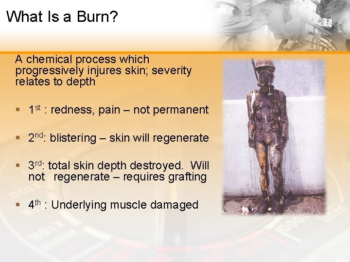 What Is a Burn? A chemical process which progressively injures skin; severity relates to
