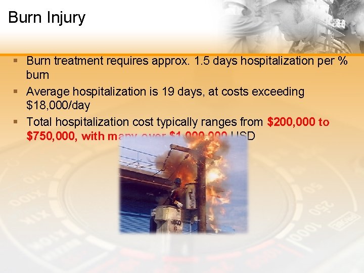 Burn Injury § Burn treatment requires approx. 1. 5 days hospitalization per % burn