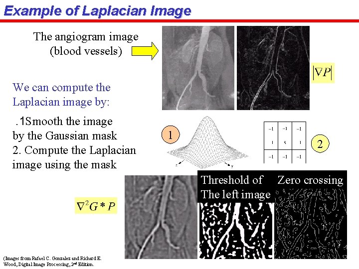 Example of Laplacian Image The angiogram image (blood vessels) We can compute the Laplacian