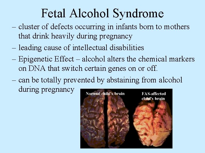 Fetal Alcohol Syndrome – cluster of defects occurring in infants born to mothers that